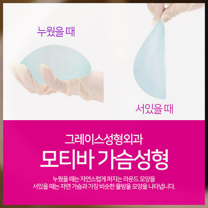 Highly Satisfying Motiva Breast Augmentation Review image 3