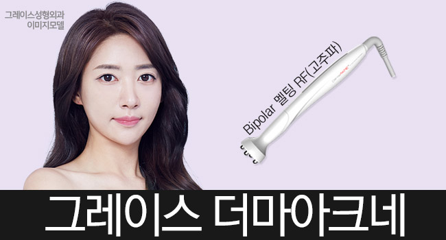신개념 여드름치료 시술 더마아크네를 알아보자 관련 이미지 6