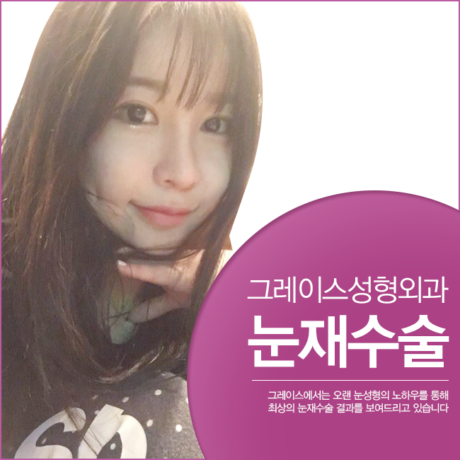 눈재수술하면 바로 이곳! 그레이스성형외과 관련 이미지 1