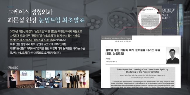 눈 커지는 법?! 그레이스성형외과 듀얼트임으로 또렷해지자! 관련 이미지 2