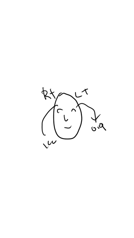 눈두덩이 부위에 절개해서 지방을 넣는다? 그레이스성형외과 아이홀 지방이식 방식에 대한 오해 관련 이미지 2