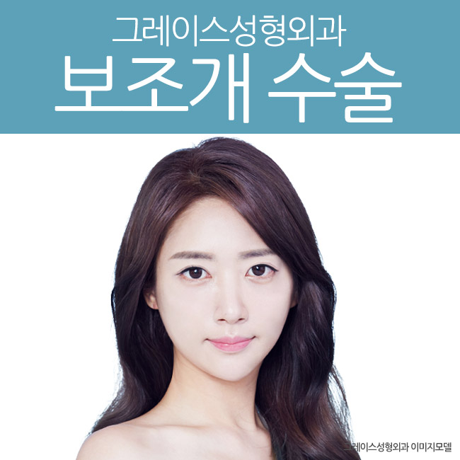 그레이스성형외과 김윤호원장님의 보조개수술 관련 이미지 3