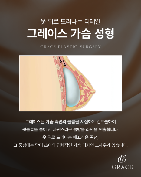 How Can Breast Augmentation Surgery Pain and Side Effects Be Reduced? image 5