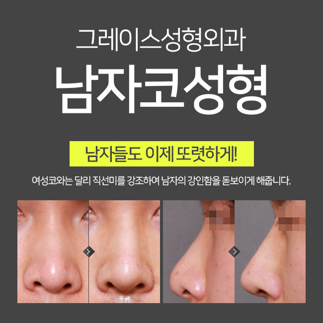 남자코성형후기는 이곳이 정답! 관련 이미지 2