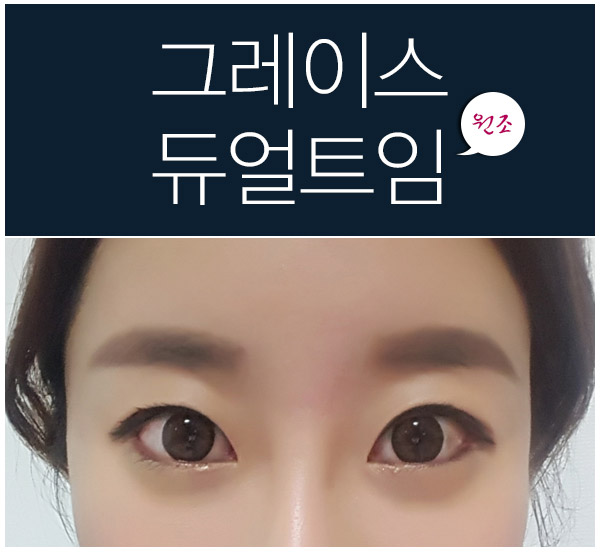 뒤트임,밑트임은 그레이스성형외과 듀얼트임으로! 관련 이미지 5
