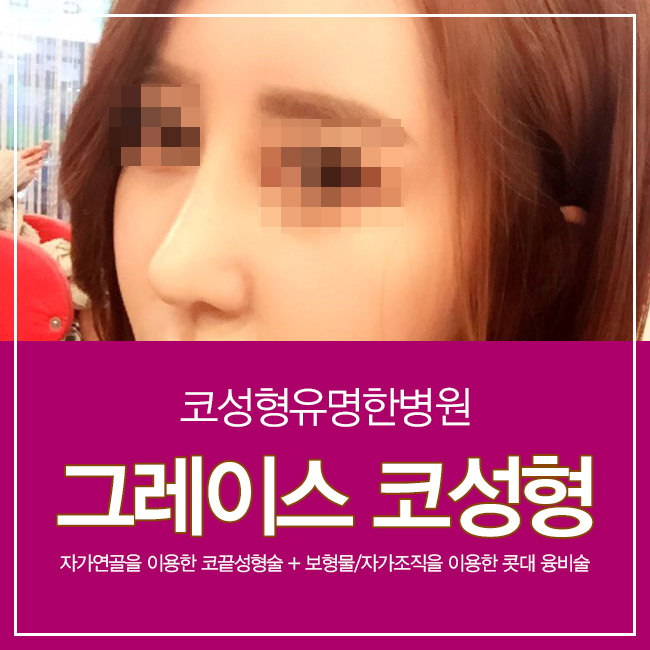 코성형유명한병원 찾는다면 여기가 정답! 관련 이미지 2