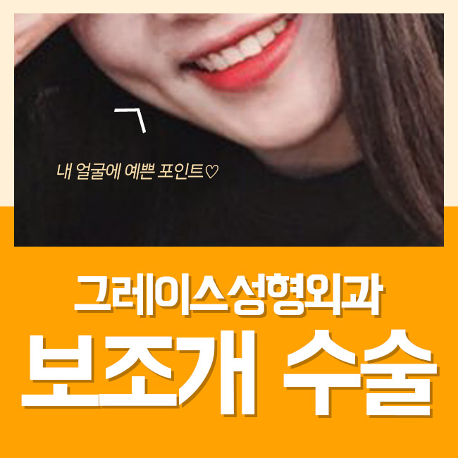 만족스러운 결과♡ 보조개수술후기를 알아본다면 관련 이미지 2