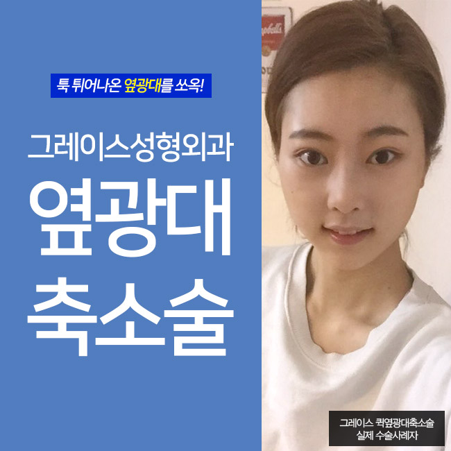 옆광대작아지는법, 옆광대축소를 알아본다면 관련 이미지 2