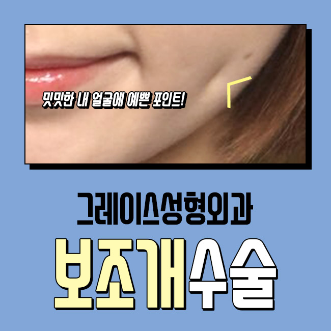 만족스러운 후기와 보조개수술가격 관련 이미지 4