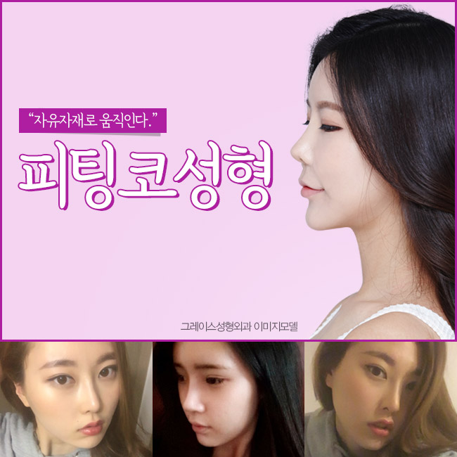 그레이스성형외과 피팅코성형, 부드럽게 움직이는 코 아직도 몰라?? 관련 이미지 3