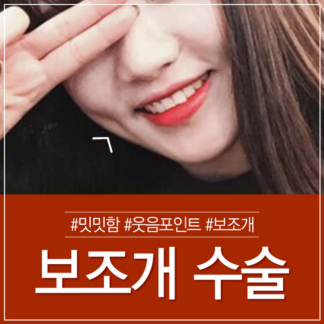 예쁜 웃음으로 연말을 따뜻하게! 그레이스성형외과 보조개수술 관련 이미지 3