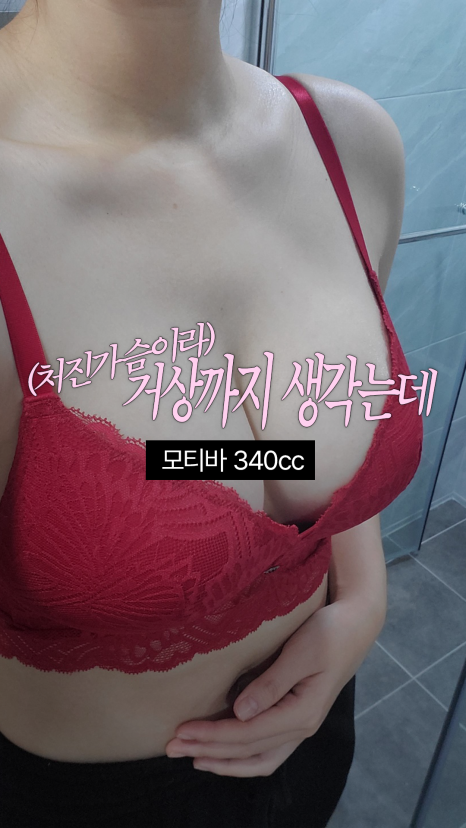 가슴성형 전후 같은 400cc인데 라인이 다른 이유 관련 이미지 5