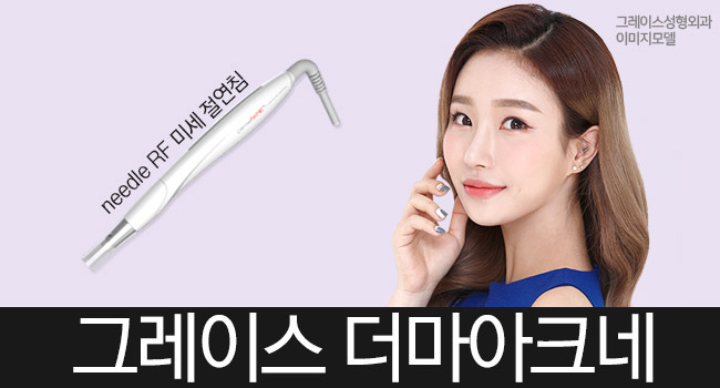 신개념 여드름치료 시술 더마아크네를 알아보자 관련 이미지 5