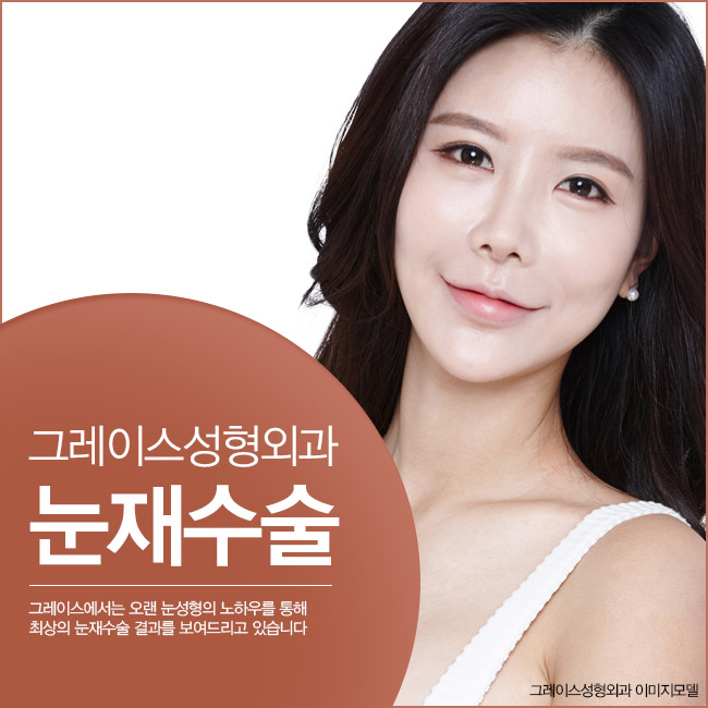 최문섭원장님이 들려주는 그레이스성형외과 눈재수술 관련 이미지 2