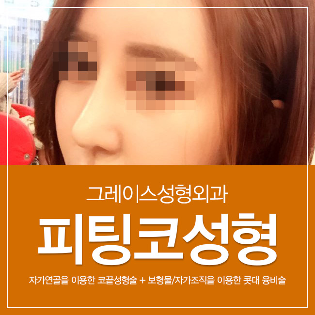 코수술후기는 움직임까지 부드러운 이곳이 정답! 관련 이미지 4