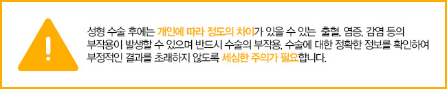 청순 눈매, 합리적인 듀얼트임가격 관련 이미지 7