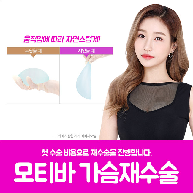첫 수술 비용의 모티바가슴재수술로 망설임을 끝내다 관련 이미지 5
