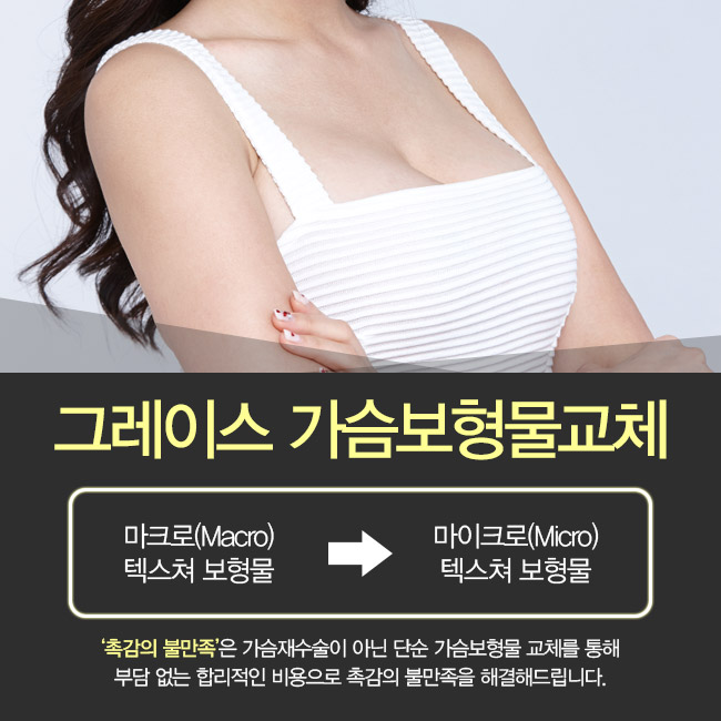 신뢰할 수 있는 실력, 가슴보형물교체는 여기서! 관련 이미지 3