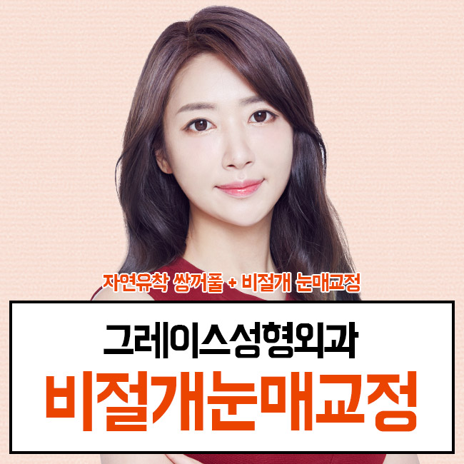 또렷한 눈의 비결, 비절개눈매교정♡ 관련 이미지 4