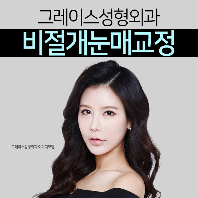 비절개눈매교정으로 또렷한 인상을 갖다! 관련 이미지 4