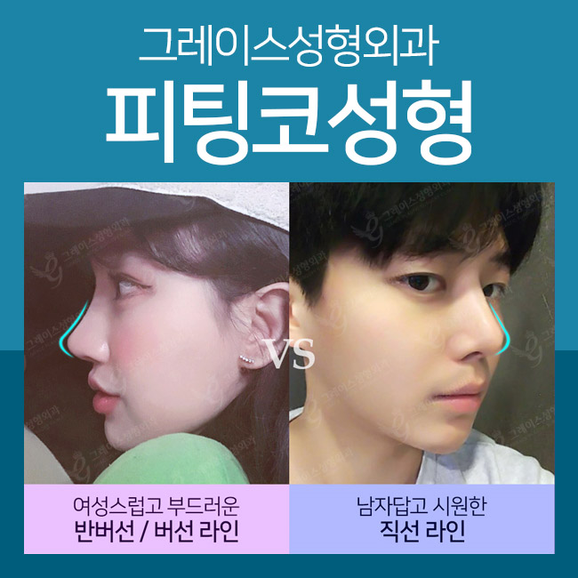 코성형외과유명한곳에서 맞춤코성형을! 관련 이미지 4