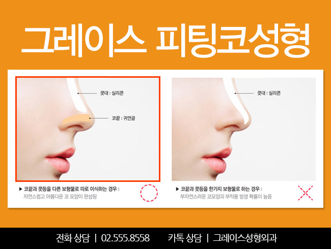 코수술후기는 움직임까지 부드러운 이곳이 정답! 관련 이미지 5