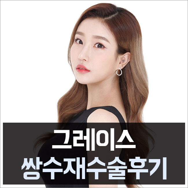 쌍수재수술후기 만족스러운 결과를 위한 선택 관련 이미지 5