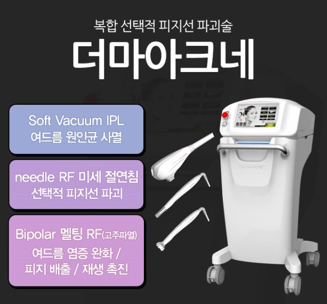 지긋지긋한 여드름, 더마아크네로 원인부터 잡자! 관련 이미지 3