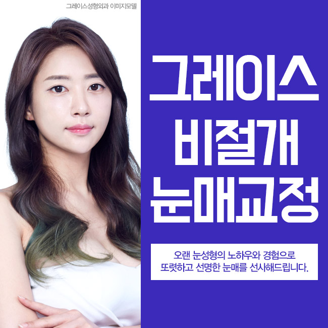 또렷한 눈매, 비절개눈매교정가격을 알아본다면 관련 이미지 4