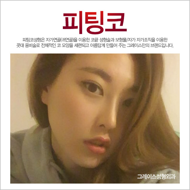 예쁜 라인과 자연스러운 움직임, 그레이스성형외과 피팅코성형 관련 이미지 3