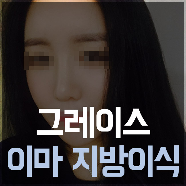 푹 꺼진 이마에 생기를 불어넣어 줄, 그레이스성형외과 이마지방이식 관련 이미지 1