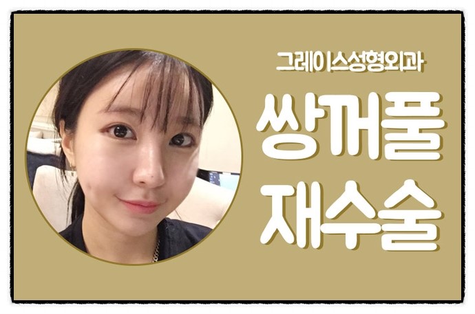 눈 재수술 잘하는 곳 그래! 그레이스성형외과 관련 이미지 4
