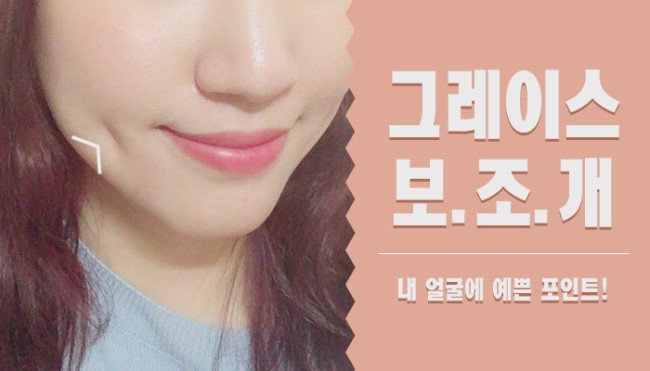 그레이스성형외과에서 보조개수술가격 알아보자! 관련 이미지 5