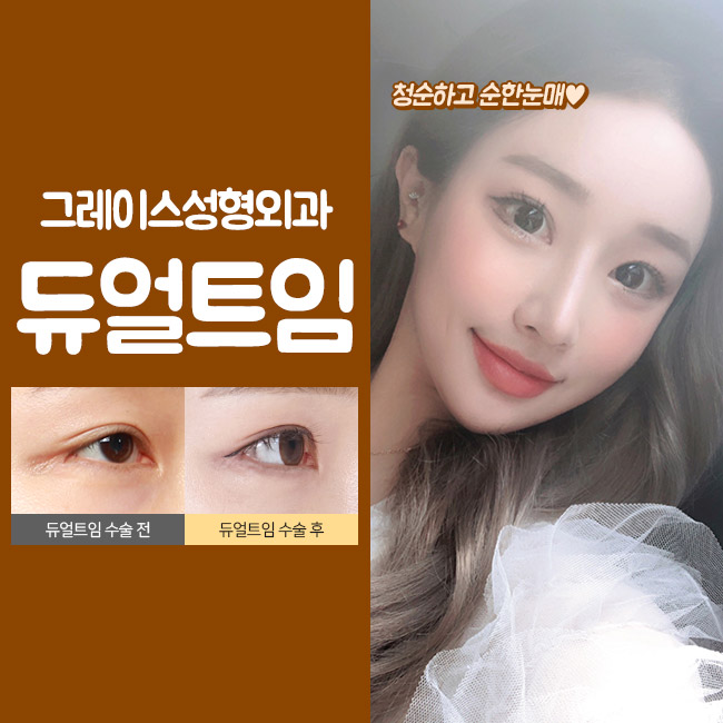 청순 눈매, 합리적인 듀얼트임가격 관련 이미지 2
