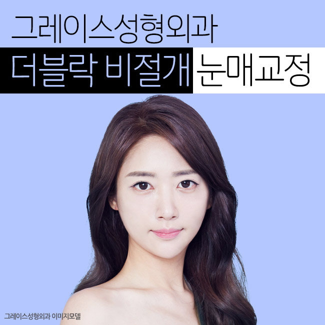 눈성형잘하는곳, 그레이스성형외과의 더블락 비절개눈매교정 관련 이미지 2