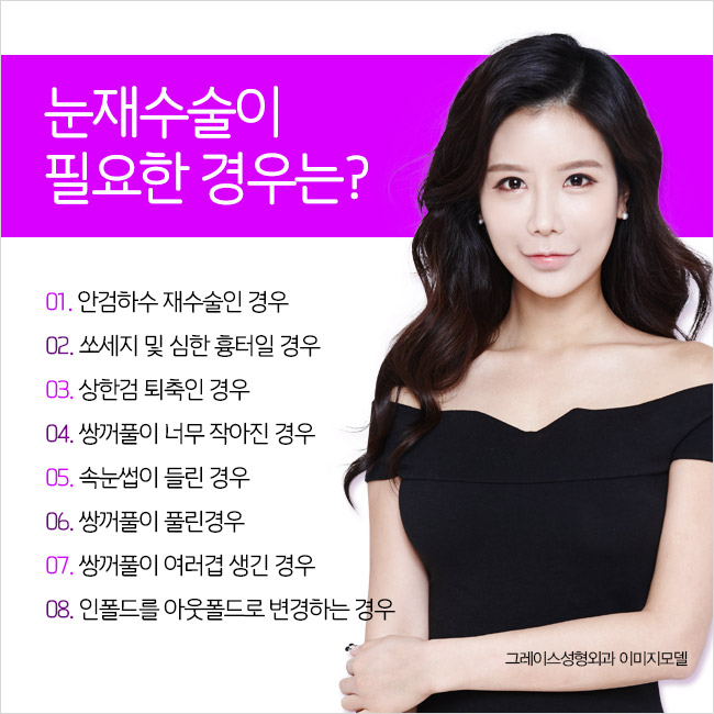 신사역 그레이스성형외과 최문섭원장님의 쌍꺼풀재수술 관련 이미지 3