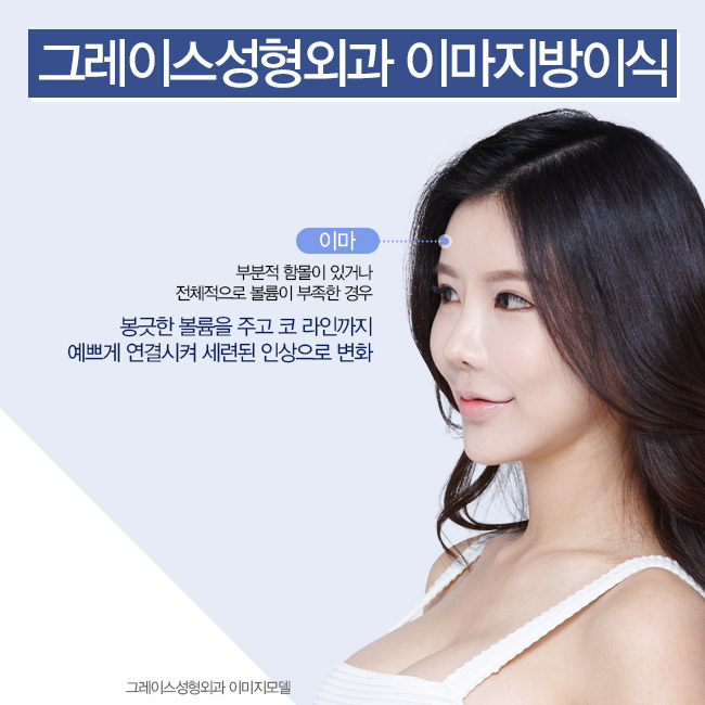 푹 꺼진 이마에 생기를 불어넣어 줄, 그레이스성형외과 이마지방이식 관련 이미지 5