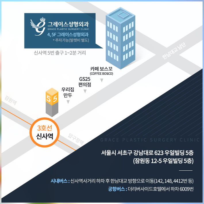 짝눈교정가격 내맘에 들도록 관련 이미지 11