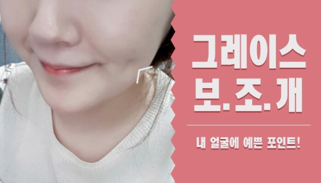 그레이스성형외과에서 보조개수술가격 알아보자! 관련 이미지 4