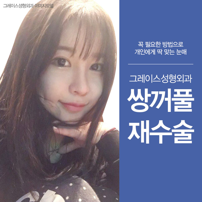 쌍꺼풀재수술은 신사역 그레이스성형외과에서! 관련 이미지 1