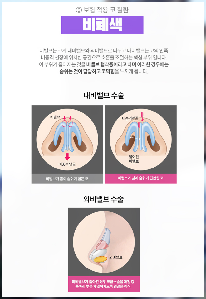 How Can You Reduce the Burden of Crooked Nose Surgery Costs? image 4