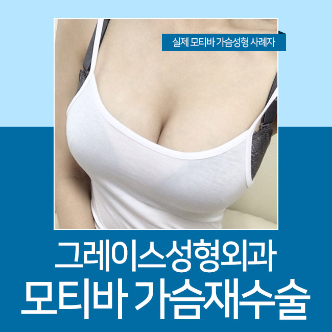 두 번 실패없는 모티바가슴재수술 놓치지마세요 관련 이미지 3