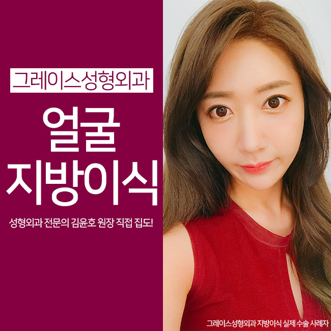 얼굴지방이식 탱탱하고 매끈한 동안얼굴을 원한다면 관련 이미지 5