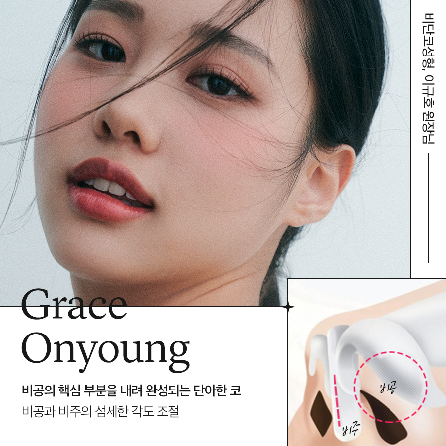비단코 성형, 이규호 원장님 코끝 성형 관련 이미지 1