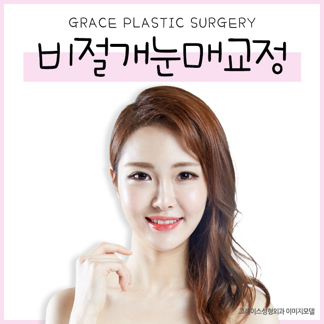 더블락 비절개눈매교정은 눈매교정잘하는곳, 그레이스성형외과에서 관련 이미지 4