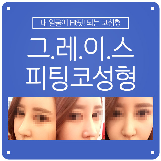 세련된 라인과 자연스러운 움직임을 모두 갖다! 그레이스성형외과 피팅코성형 관련 이미지 3