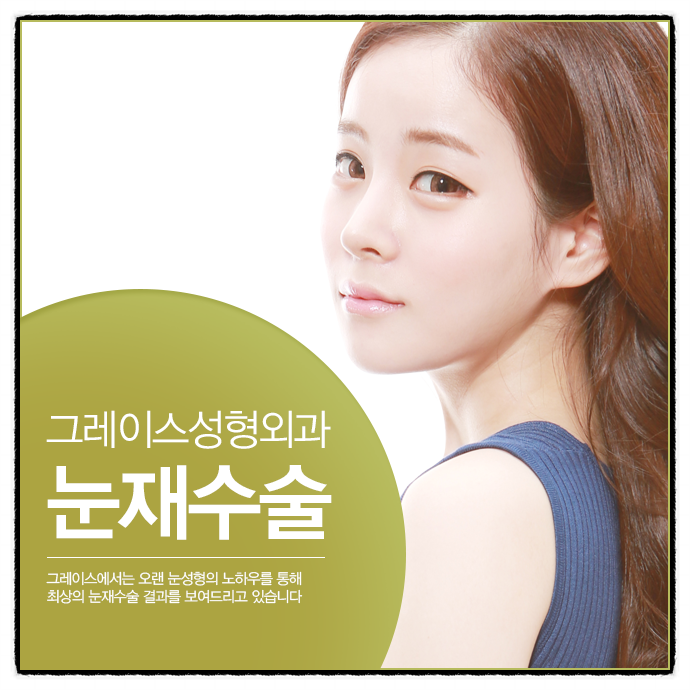 눈 재수술 잘하는 곳 그래! 그레이스성형외과 관련 이미지 1