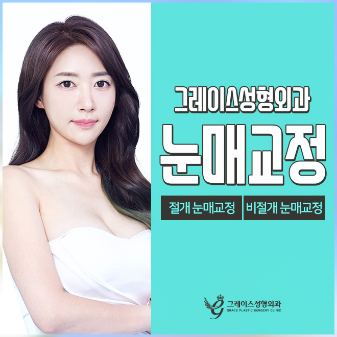 짝눈교정가격 내맘에 들도록 관련 이미지 2
