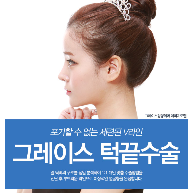 그레이스성형외과 턱끝수술로 돌출입 교정! 관련 이미지 4