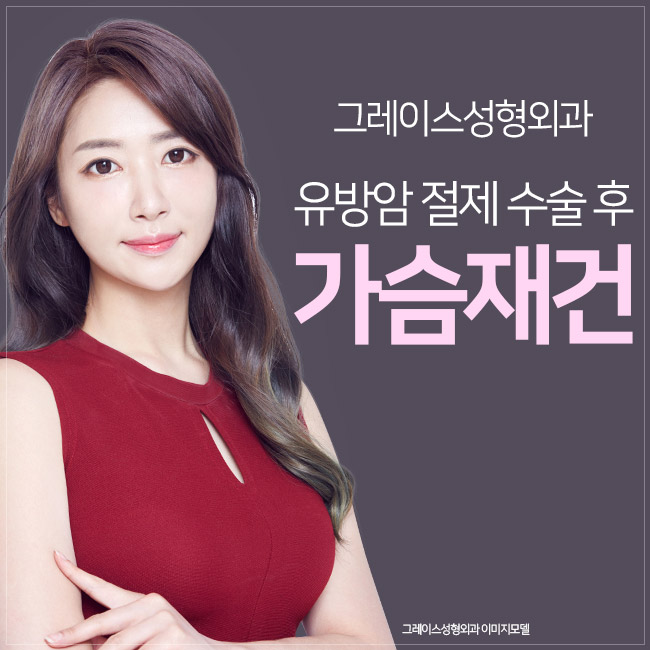 유방암 절제 수술 후, 가슴재건수술 관련 이미지 3